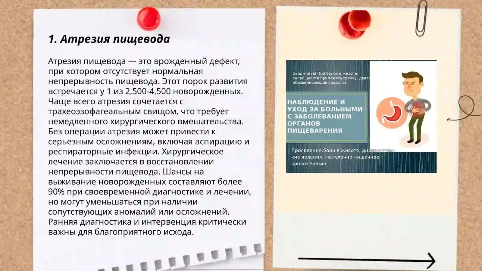 Пищеварительная система аномалия 3