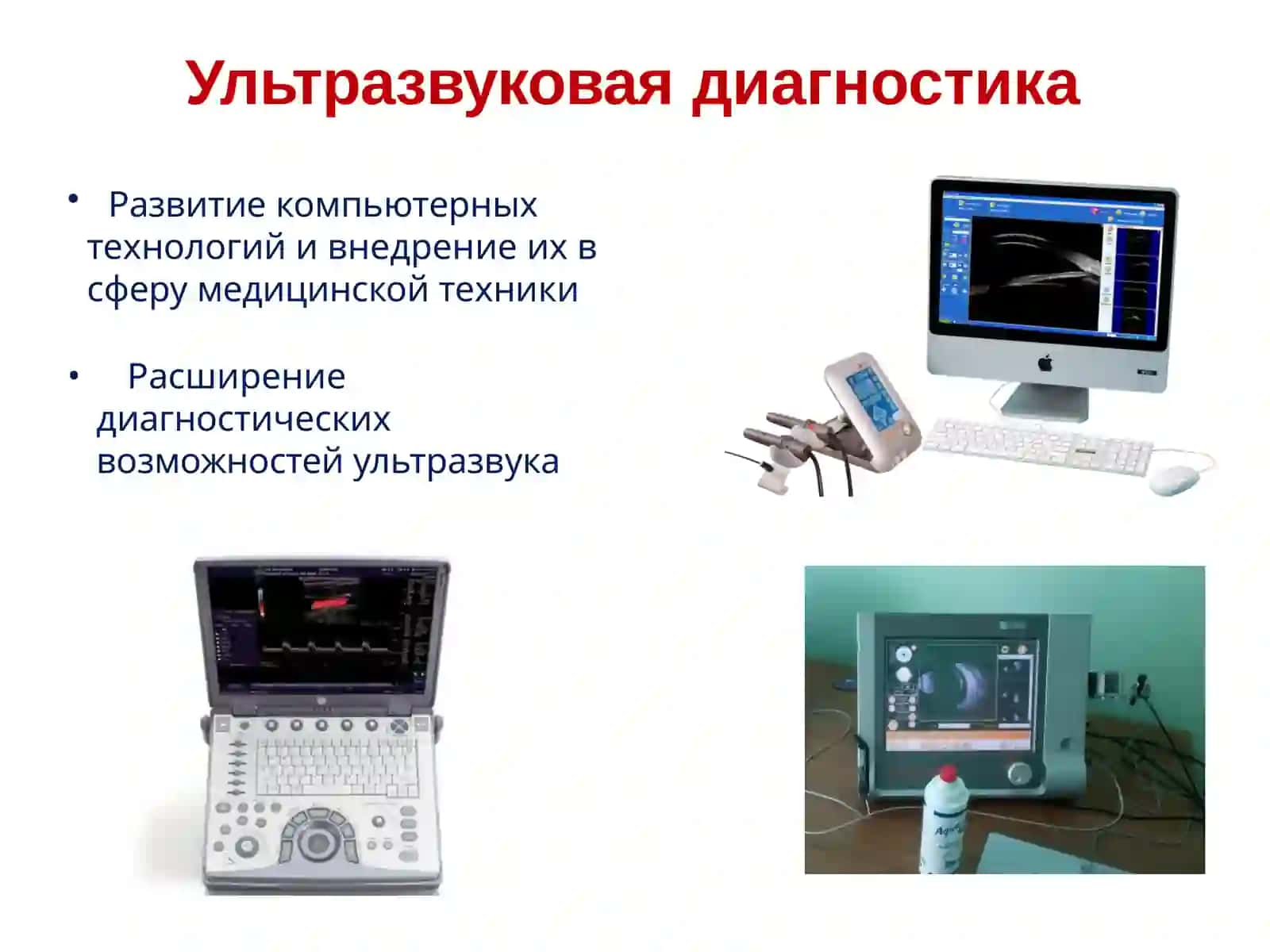 Ультразвуковая диагностика патологии глаза и орбиты 3