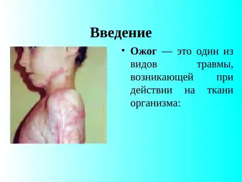 Бушадагонлар. Соғдар. Электро ёрағ'и 3