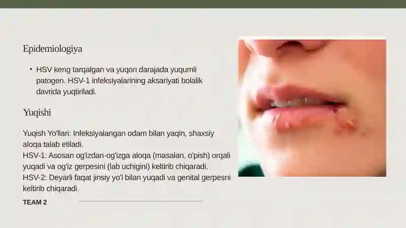 Oʼtkir gerpes va sitomegalovirus 3