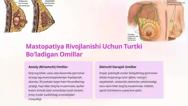 Mastopatiya — Alomatlari, Tasnifi, Sabablari, Tashxislash, Davolash, Oldini Olish 3