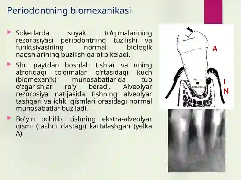 Travmatik oklyuziya. Travmatik oklyuziyaning differentsial diagnostikasi. 3