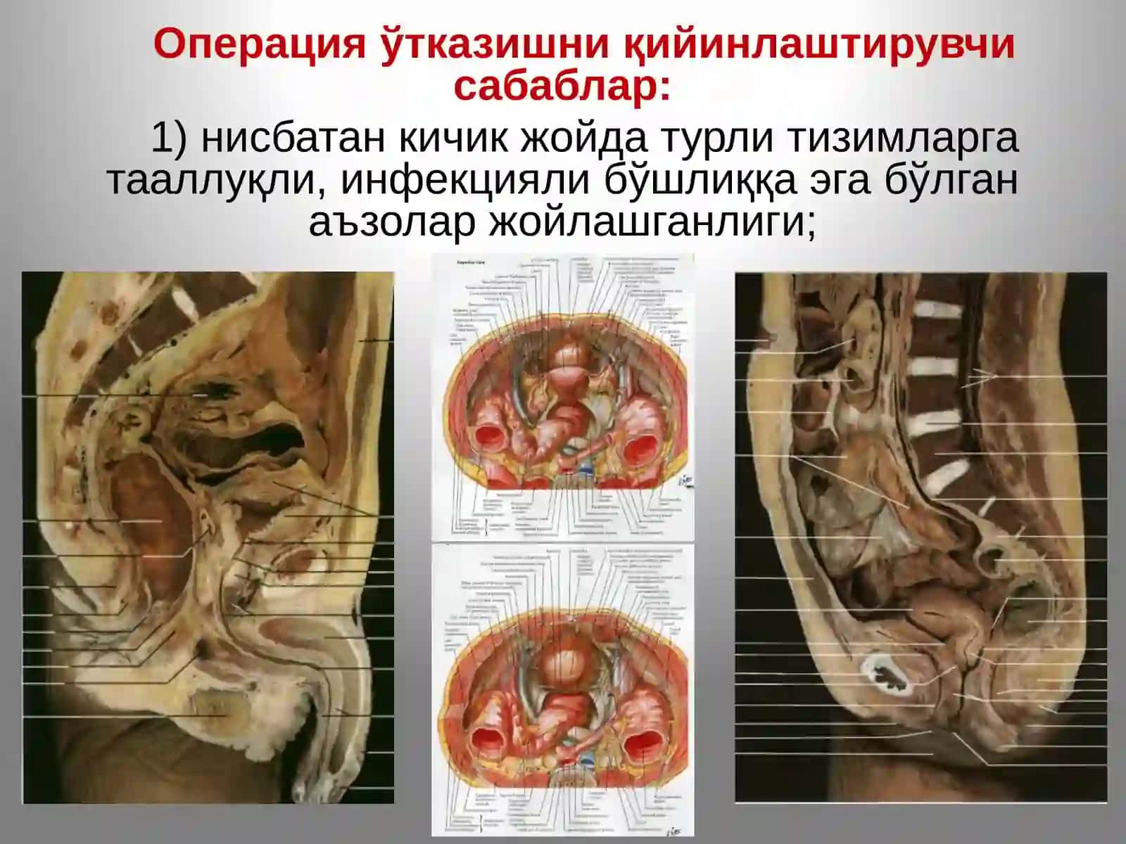 Тос соҳаси ва ундаги аъзолар топографик анатомияси 3