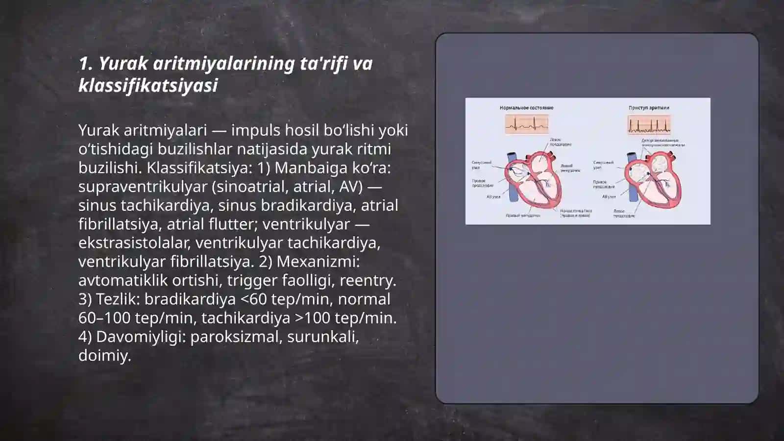 Yurak aritmiyalari. Kelib chiqishi sabablari, Va rivojlanish mexanizmlari turlari, belgilari EKGdagi o’zgarishlar 3