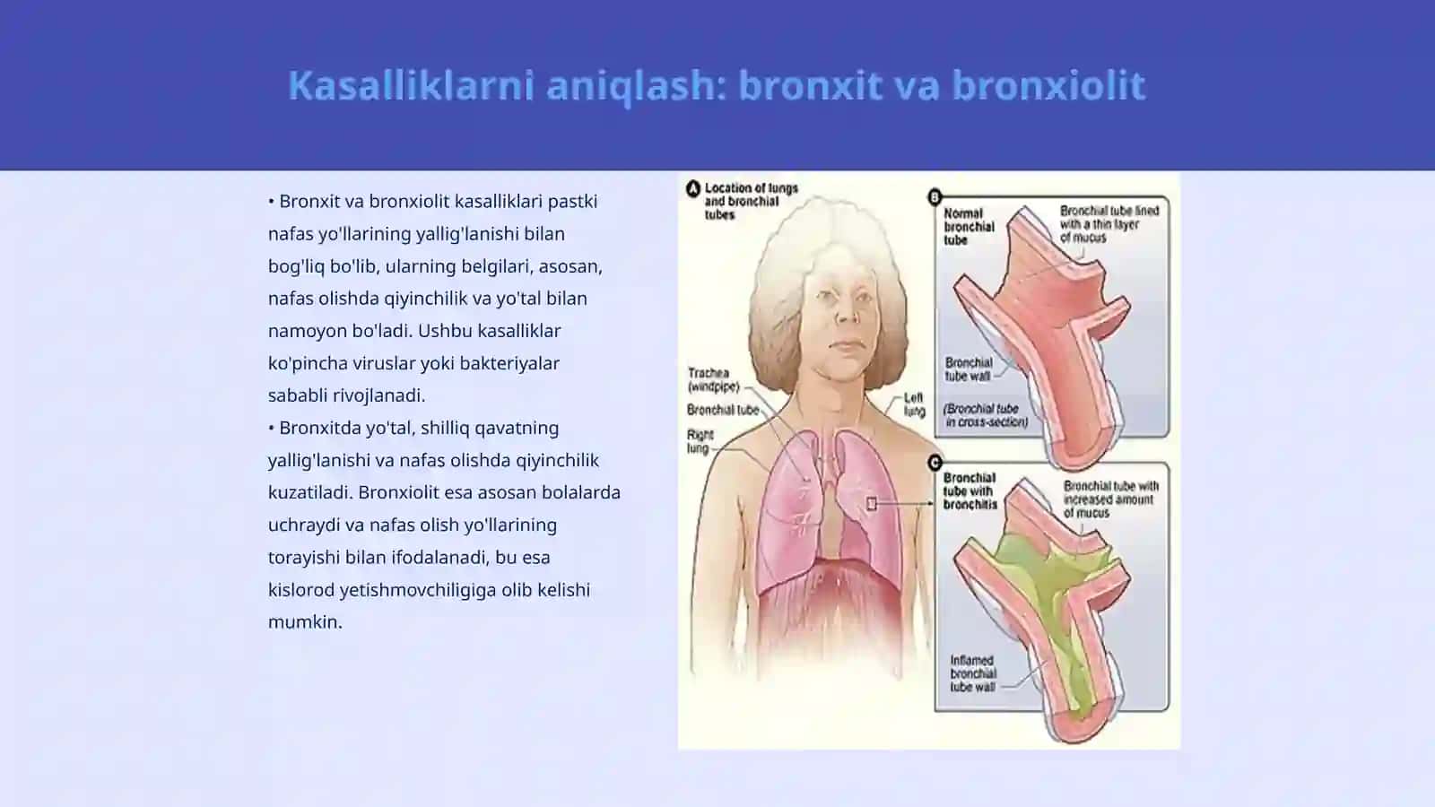 Pastki nafas yo'llari kasalliklarini tashxislash mezonlari: bronxit, bronxiolit, pnevmoniya OSh taktikasi. Davosi dispanser kuzatuvi 3