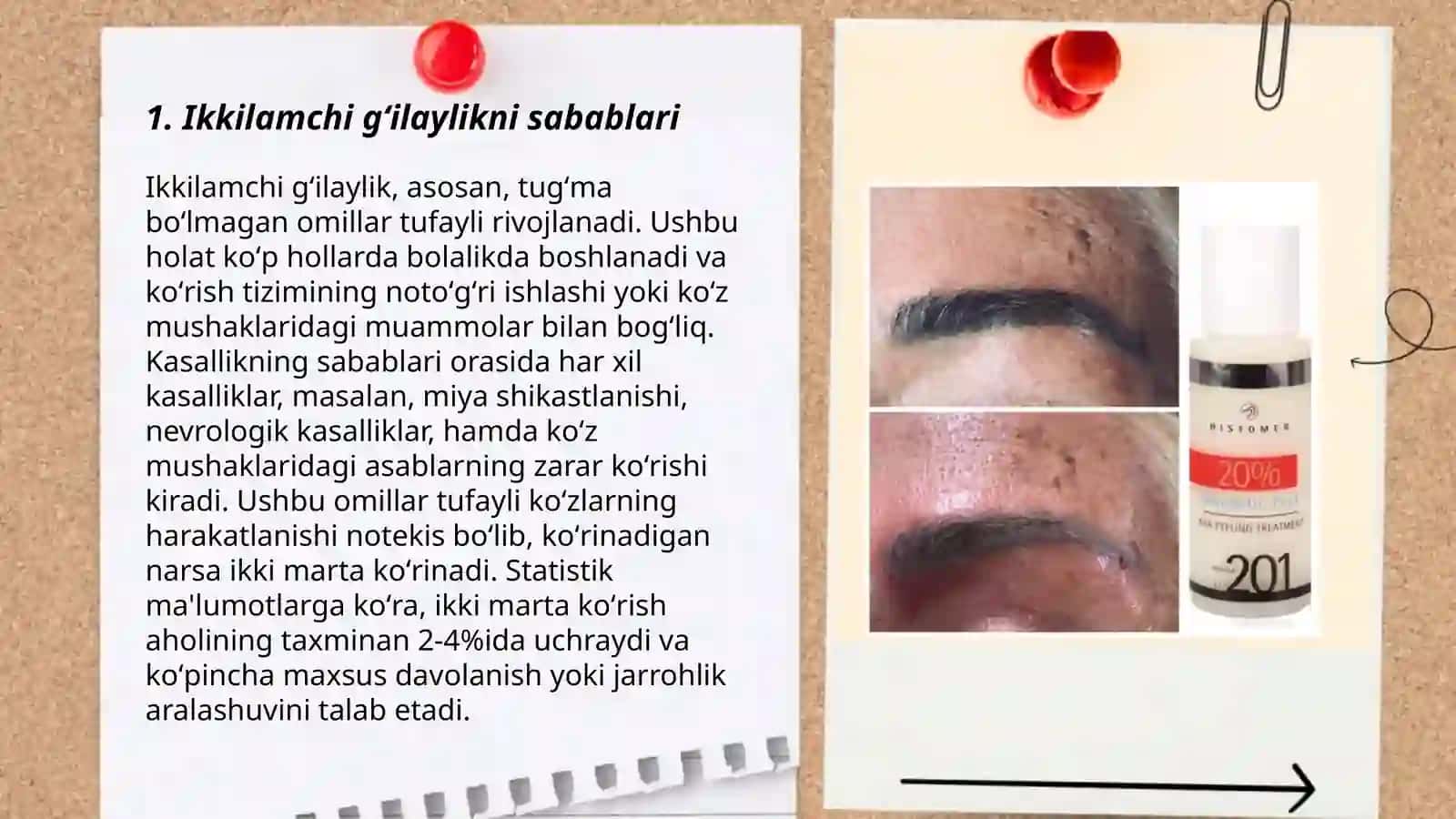Ikkilamchi gʻilaylikni davolash 3