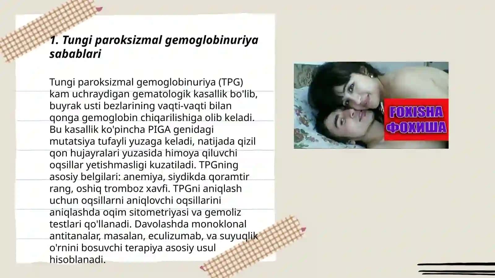 Tungi paroksizmal gemoglobinuriya 3