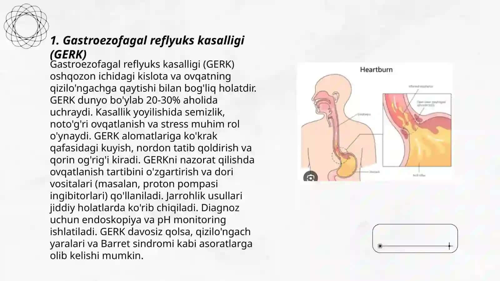 Gastroezofagal reflyuks kasalligi (GERK) 3