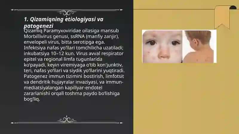 Qizamiq etologiyasi epidemologiyasi kilinikasi davolash oldini olish 3