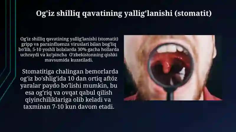 GRIP PARAGRIP QIZAMIQ MARFOLOGIYASI OG'IZ BOSHLIG'IDAGI ASORATLAR 3