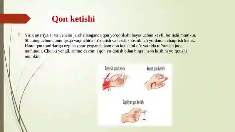 QON KETISHI — TURLARI, QON KETGANDA BIRINCHI YORDAM KO’RSATISH, QONNI TO’XTATISH USULLARI 3