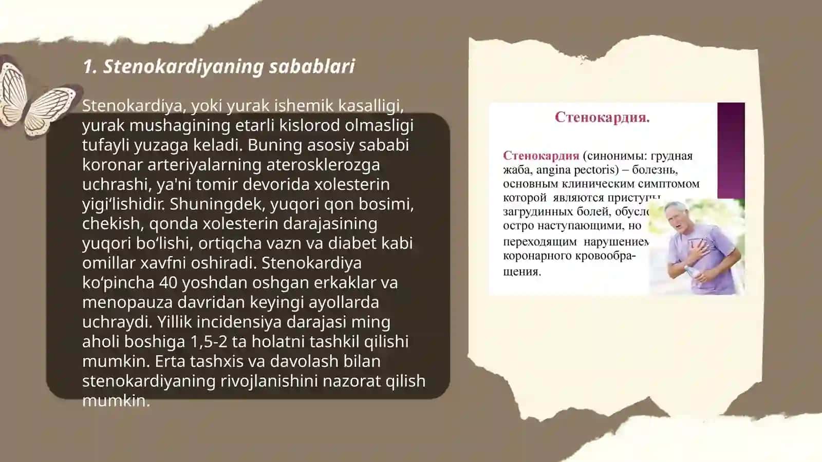 Stenokardiya 3