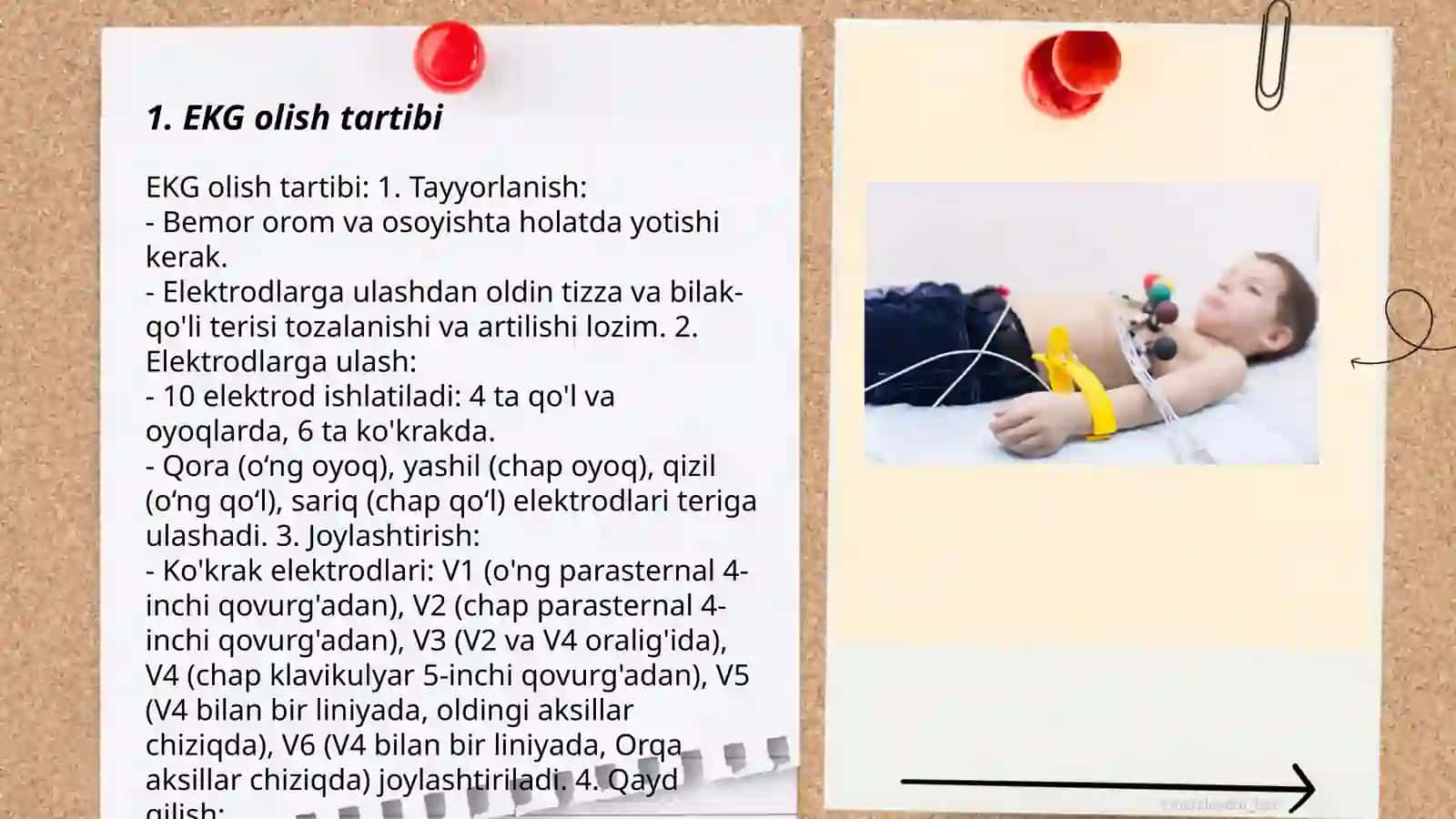 EKG olish tartibi va qadamma qadam bajarish amaliy koʻnikmasi 3