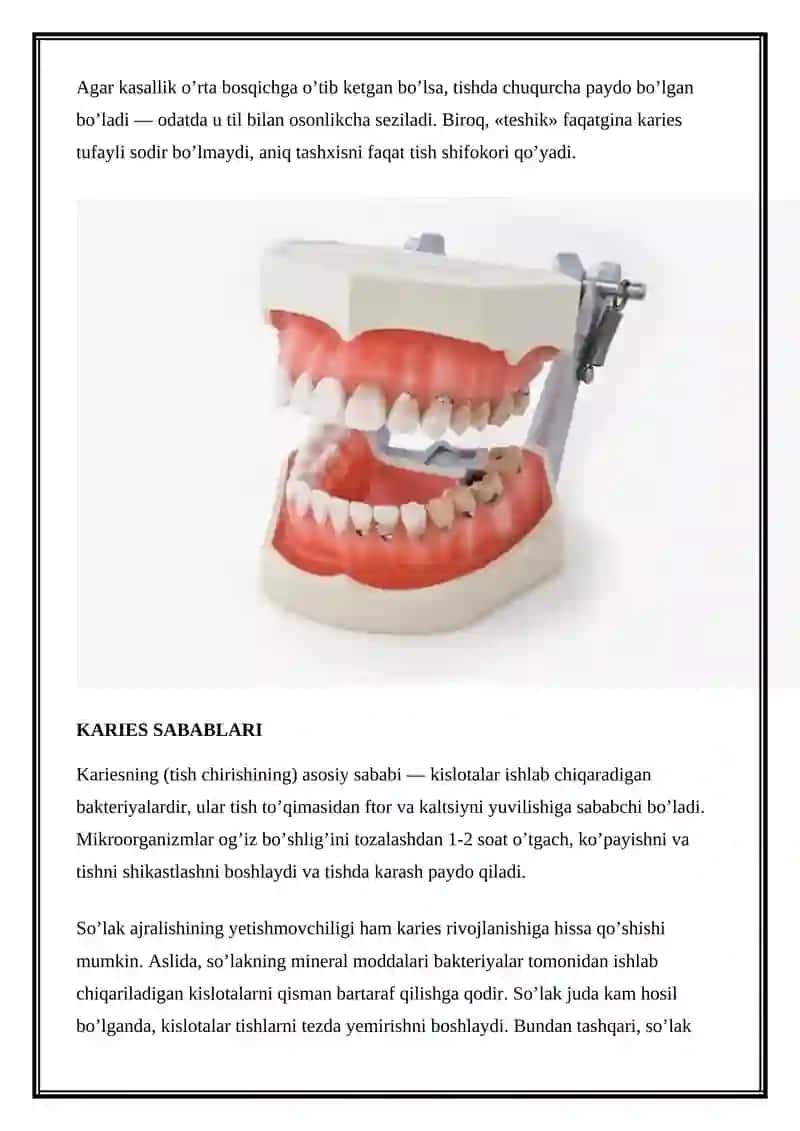 Karies 3