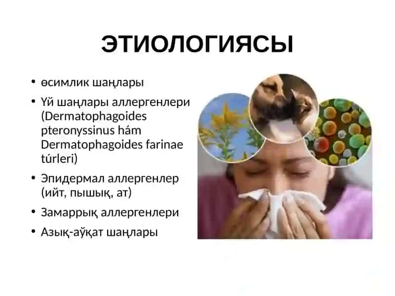 Аллергик ринит 3