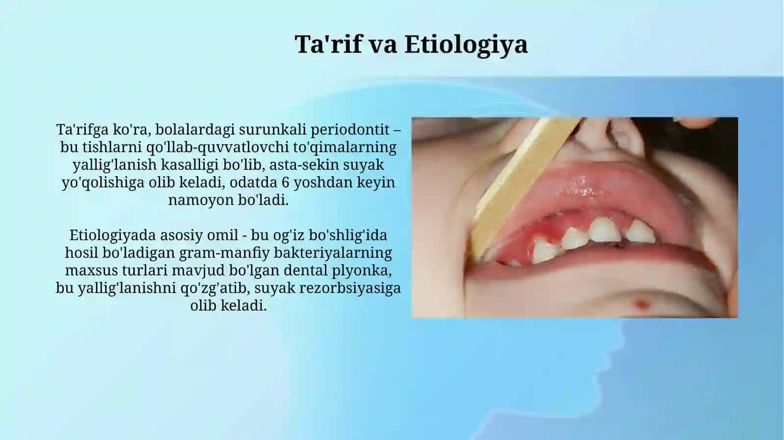 Bolalarda surunkali periodontit 3