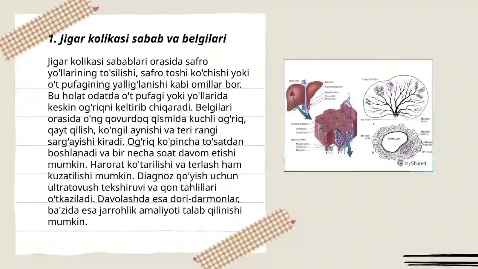 Jigar kolikasi,sariqlik sindromi,jigar disfunksiyasi sindromlarining ratsional terapiyasiga klinik-farmakologik yondashuv 3