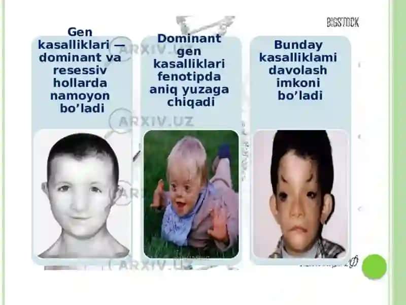 Amaliy mashg’ulot: Gen kasalliklari. Odamlar normal va patologik belgilarning irsiy ko'rsatilishi 3