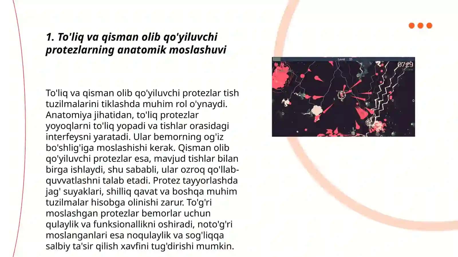 To'liq va qisman olib qo'yiluvchi protezlarni tanlash 3