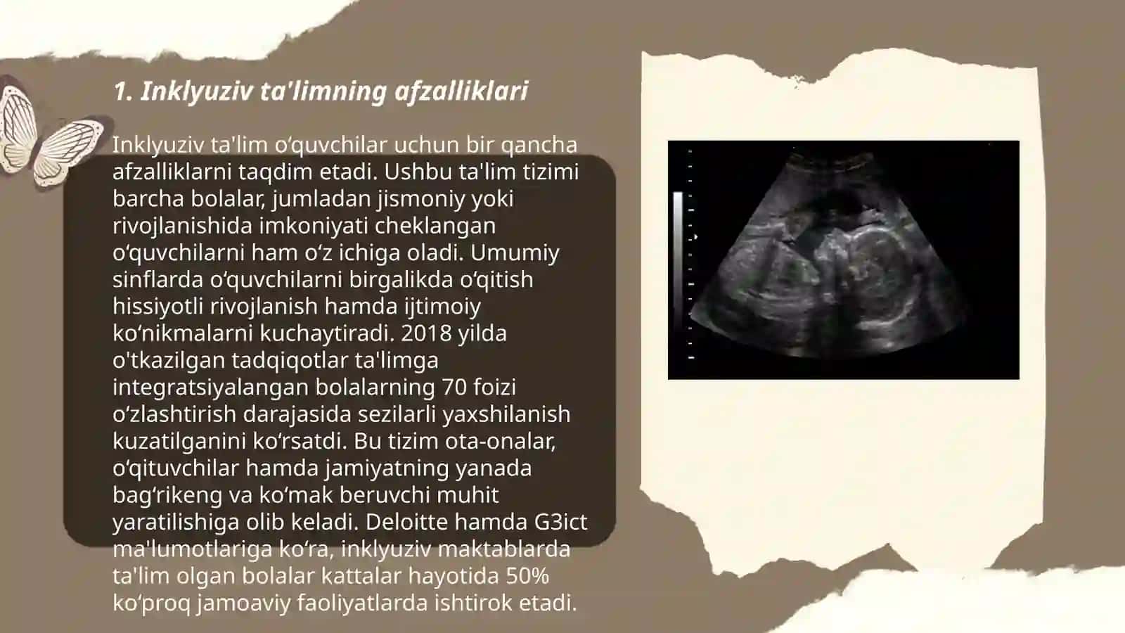 Inklyuziv ta'limning afzalliklari 3