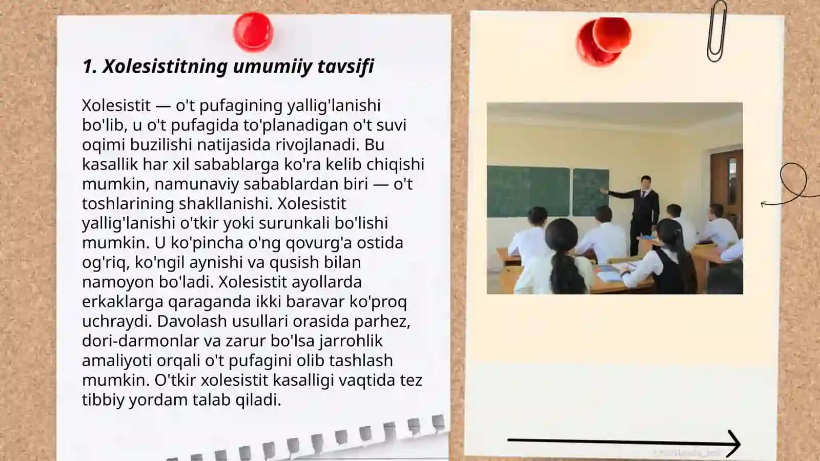 Xolesistit kasalligida jismoniy mashq majmuasini tuzish 3