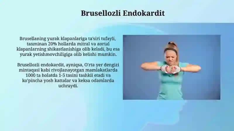 Brusellozdagi Yurak-Qon Tomir Asoratlari va Davolash 3