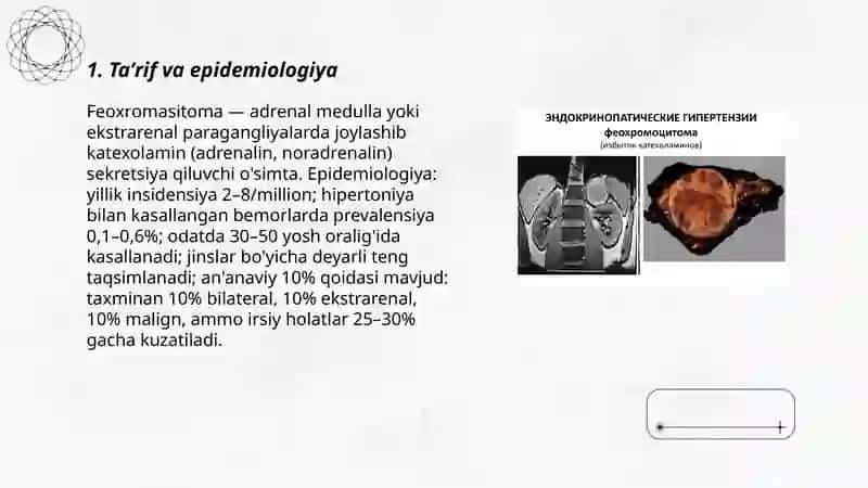 Feoxromasitoma kasalligi 3