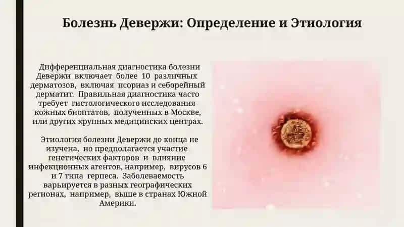 Болезнь Девержи 3