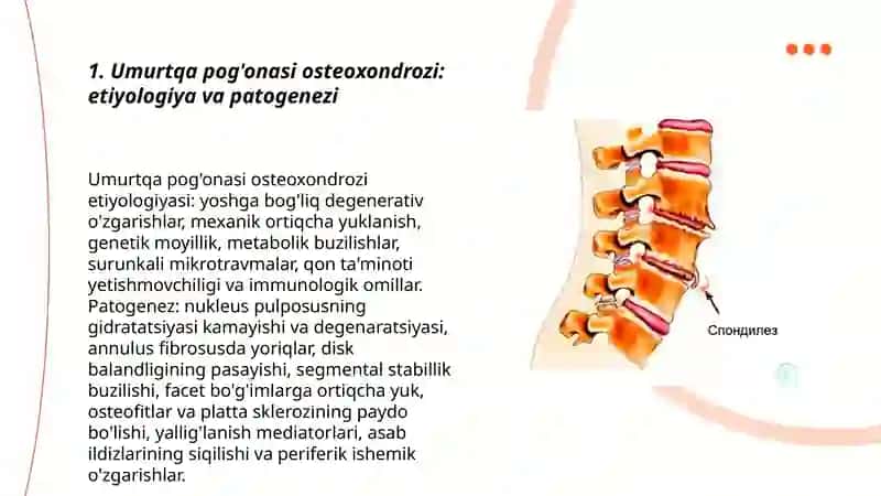 Umurtqalar osteoxondrozi. Spondilyoz. Spondiloartroz 3