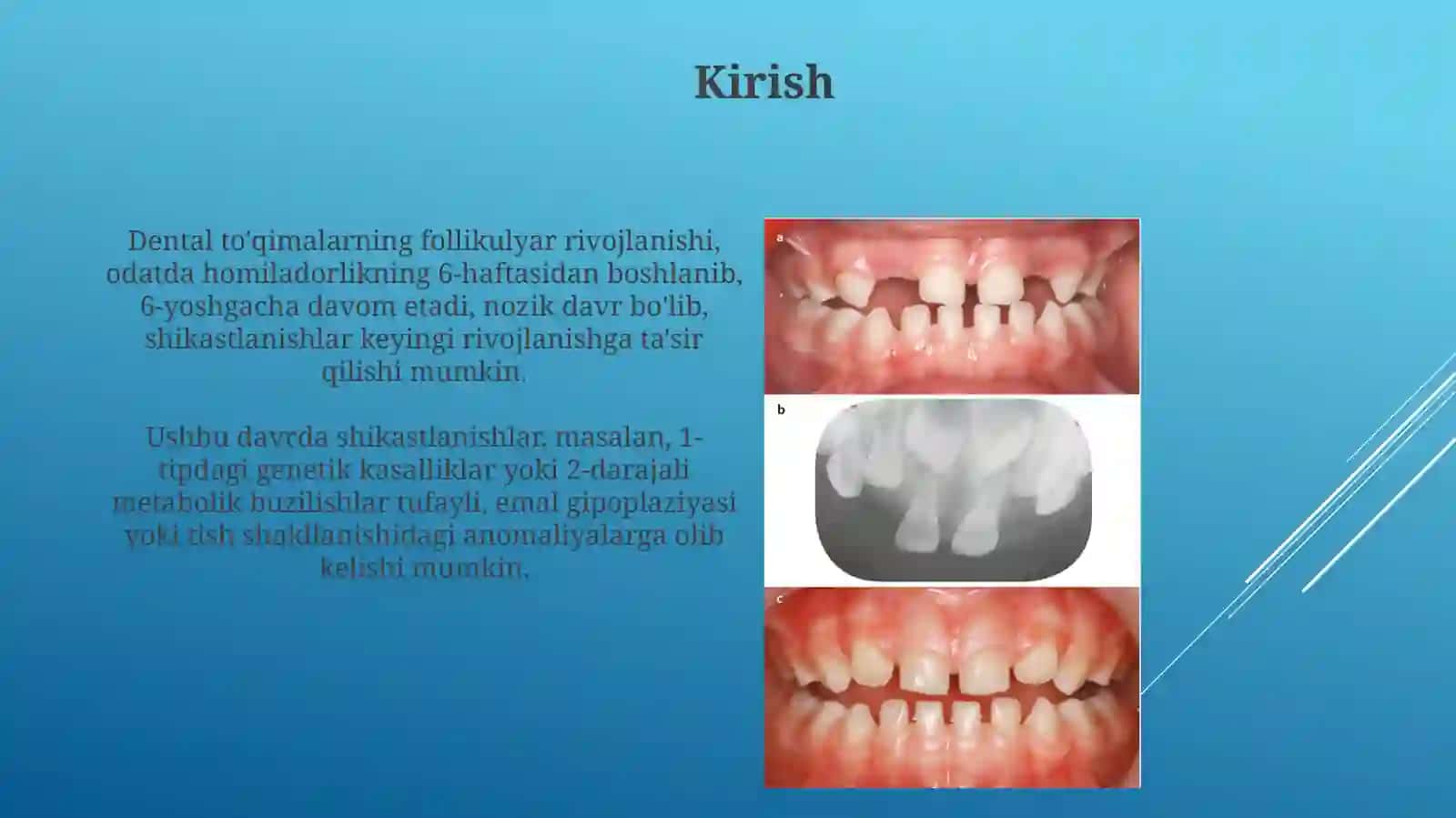 Tishto’qimalarining follikulyar rivojlanishi 3