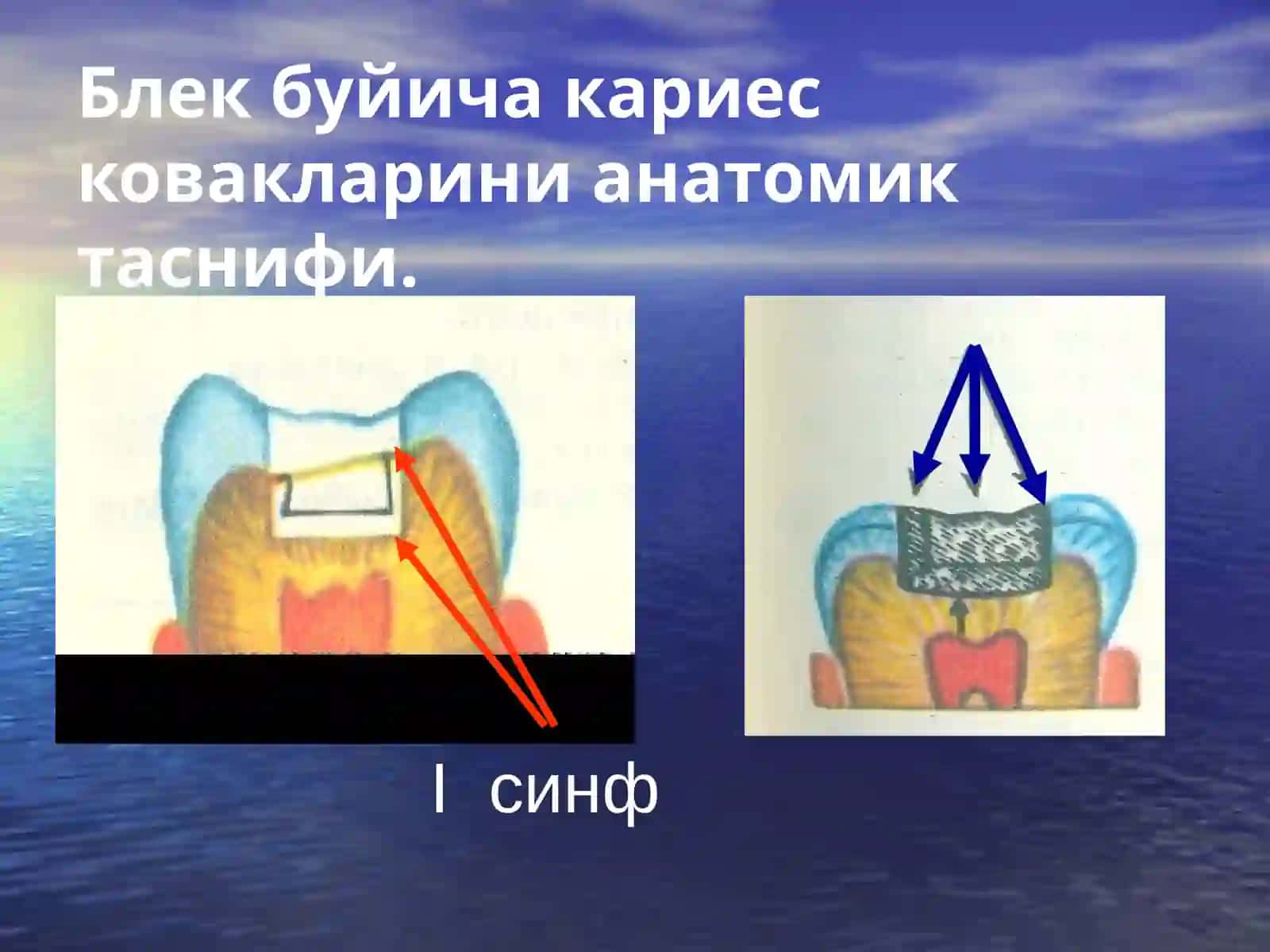 Кариесковакни чархлаш босқичлари ва ускублари 3