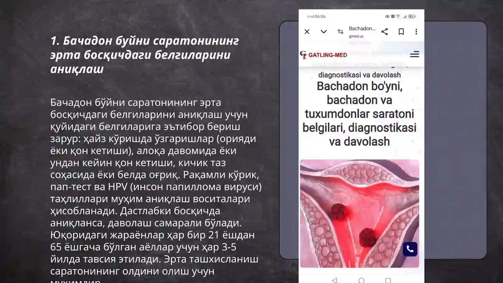 Бачадон буйни саратоннинг олдини олиш давоси диагностикаси 3