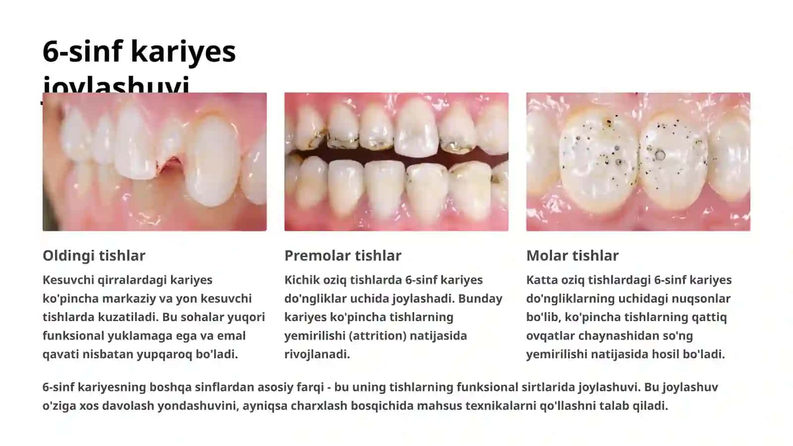 6-sinf karies kovaklarni charxlashning o'ziga xos tomonlari 3