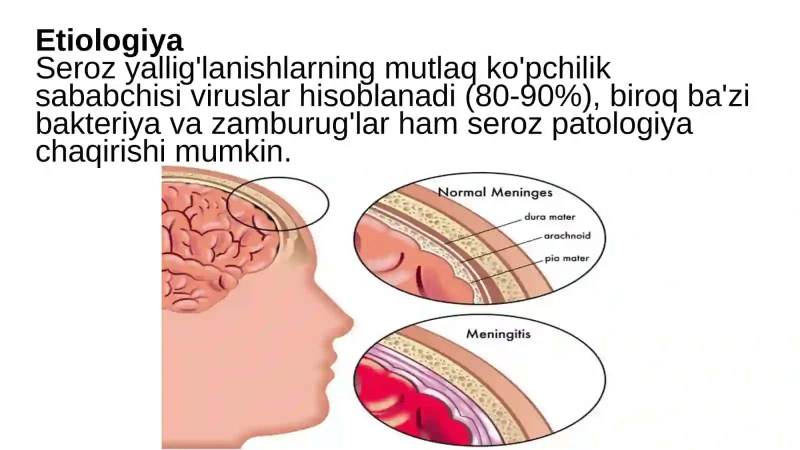 Seroz meningitlar va Meningoensefalitlar 3