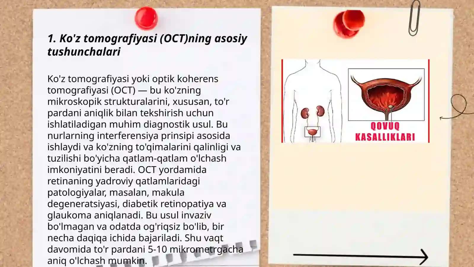 Ko’z tomografiyasi (OCT)va ko’z kasalliklarini tashxislash 3