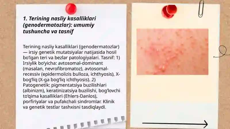 Terining nasliy kasalliklari (dermatozlar). Qandsiz diabet kasalligi Abdurasulova Gulshod 3