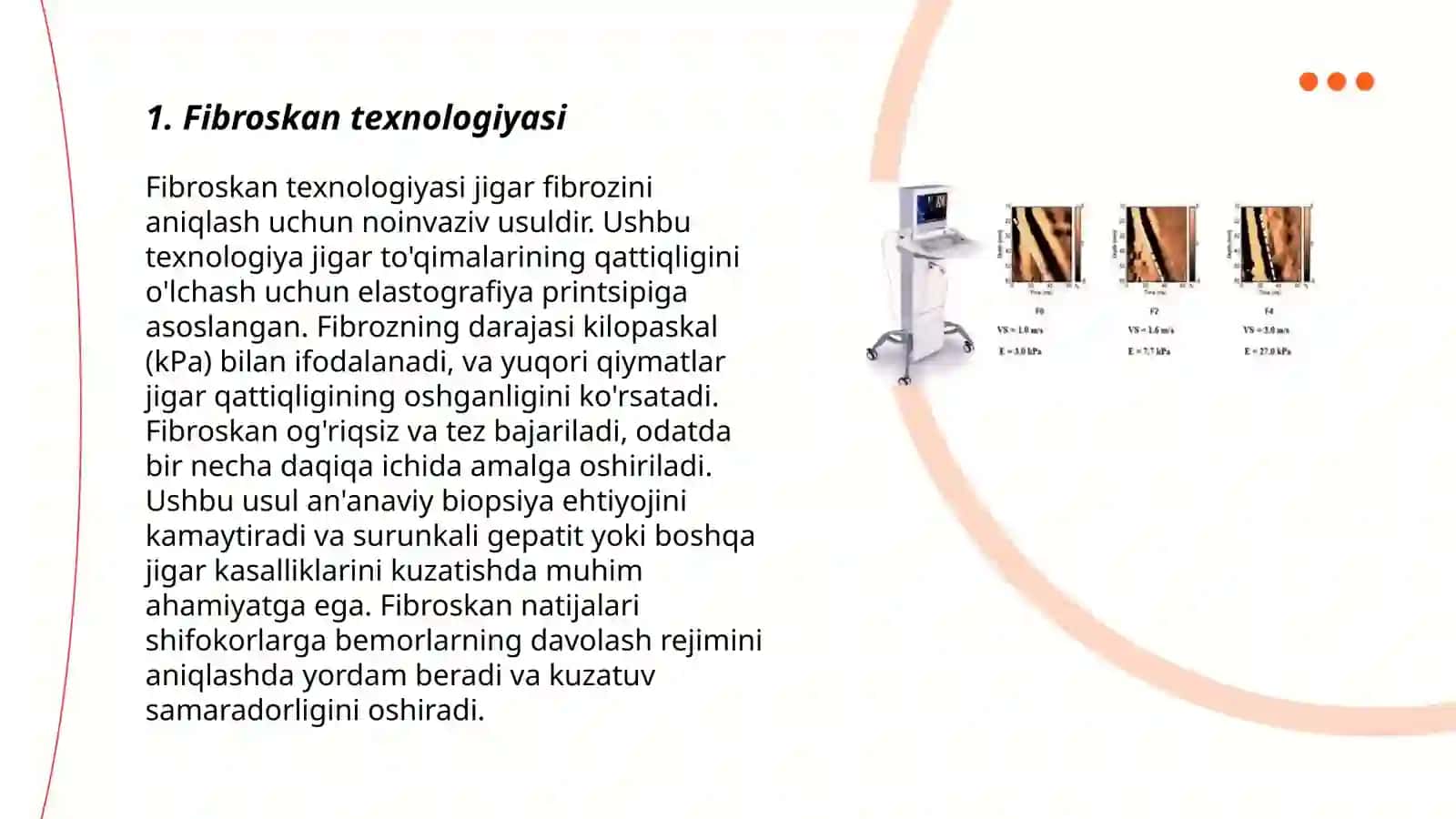 Fibroskan 3