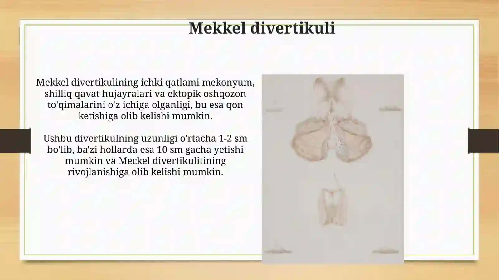 Hazm a'zolarini rentgenanatomiyasi va rivojlanish nuqsonlari 3