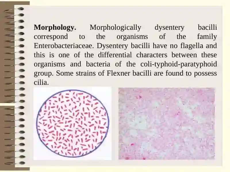 Causative agents of Shigellosis 3