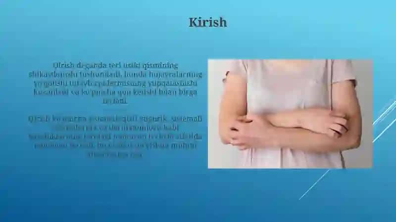 Tizimliqizilyugirik.Tizimlisklerodermiya.Dermatomiozitlar 3