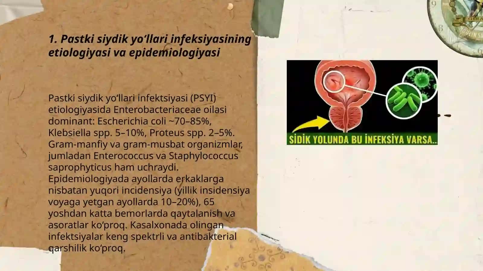 Pastki siydik yoʻllari infeksiyasi 3