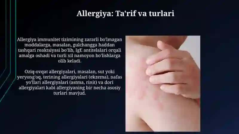 Allergiya 3