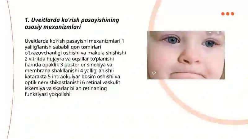 Uveitlarda ko’rish pasayishi va profilaktikasi 3