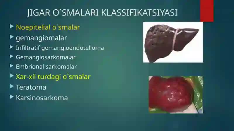 JIGAR O`SMA KASALLIKLARI 3
