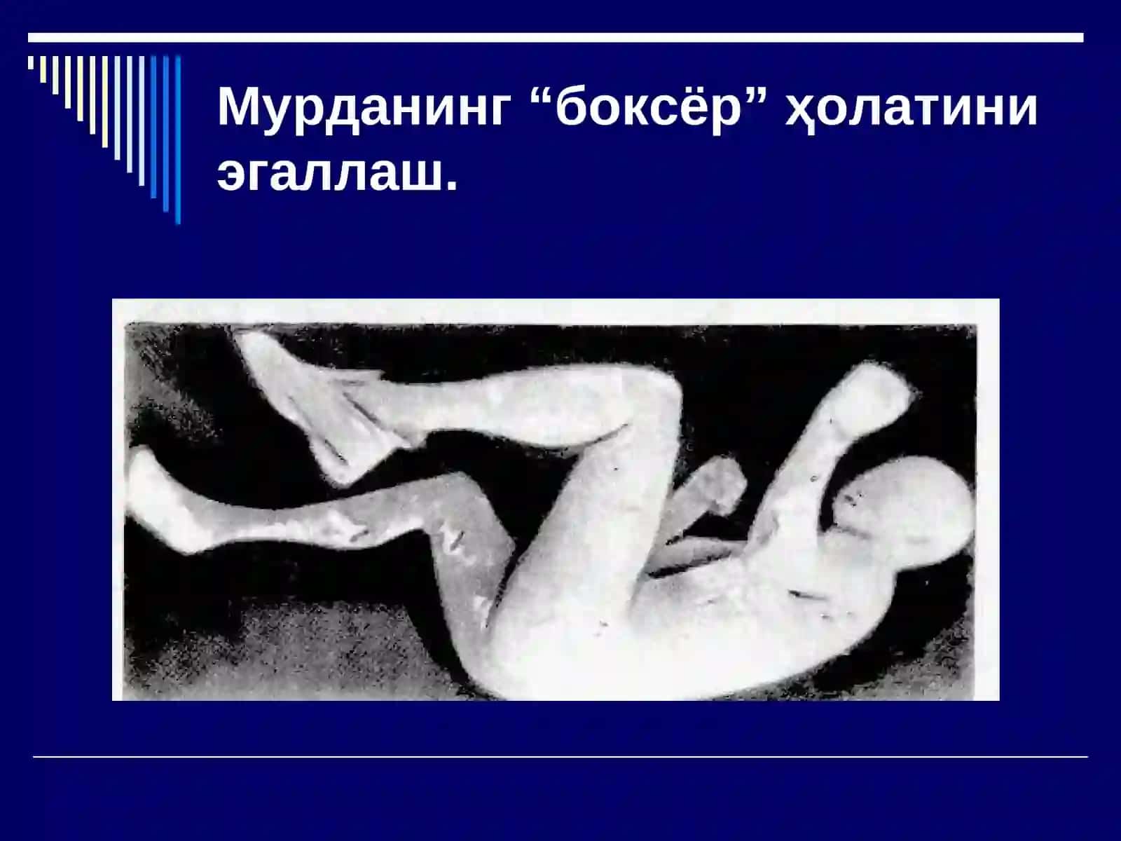 АЙРИМФИЗИК ЖАРОҲАТЛАР 3