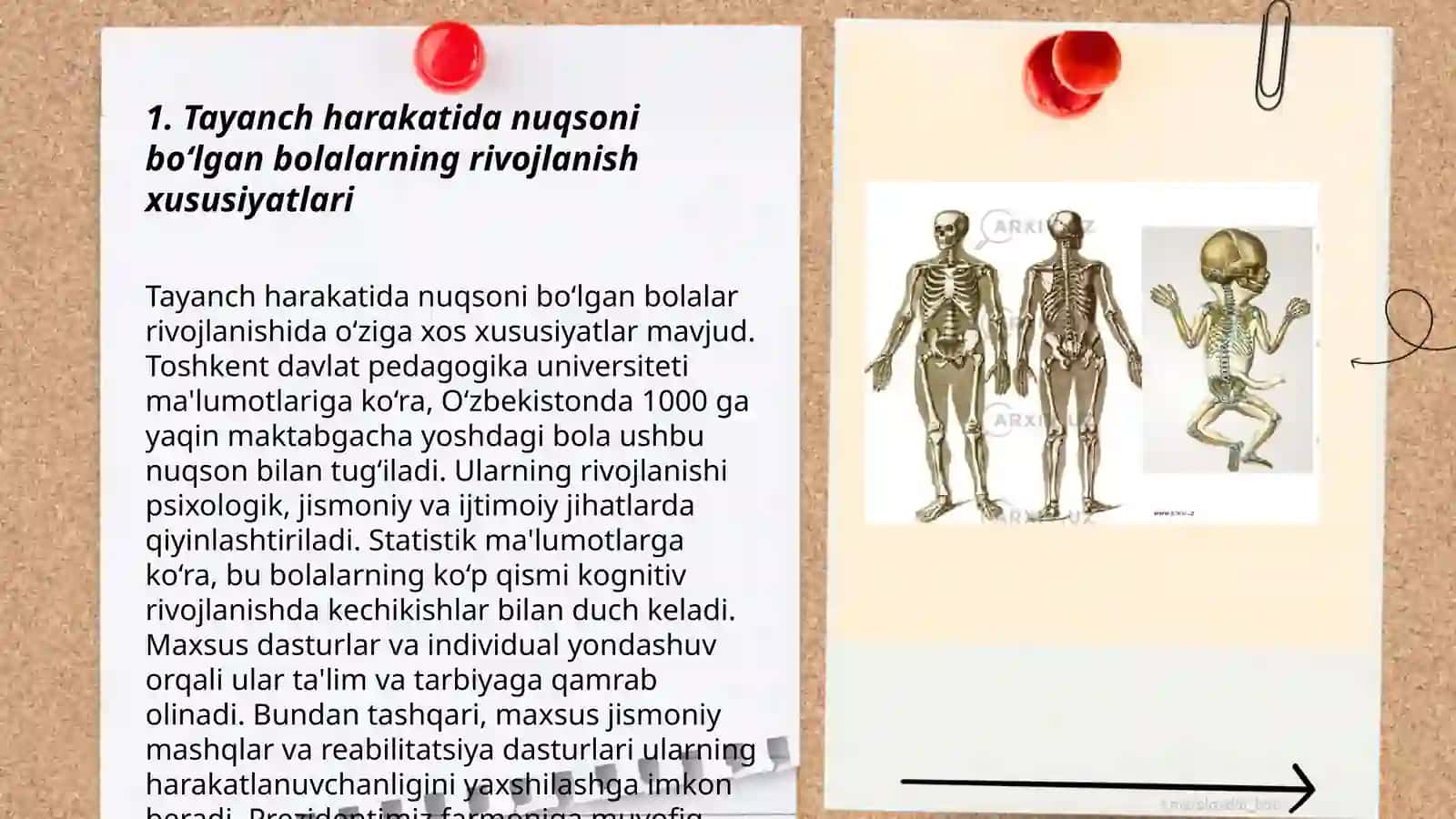 Tayanch harakatida nuqsoni bolgan bolalarning ijtimoiy-psixologik va pedagogik xususiyatlari 3