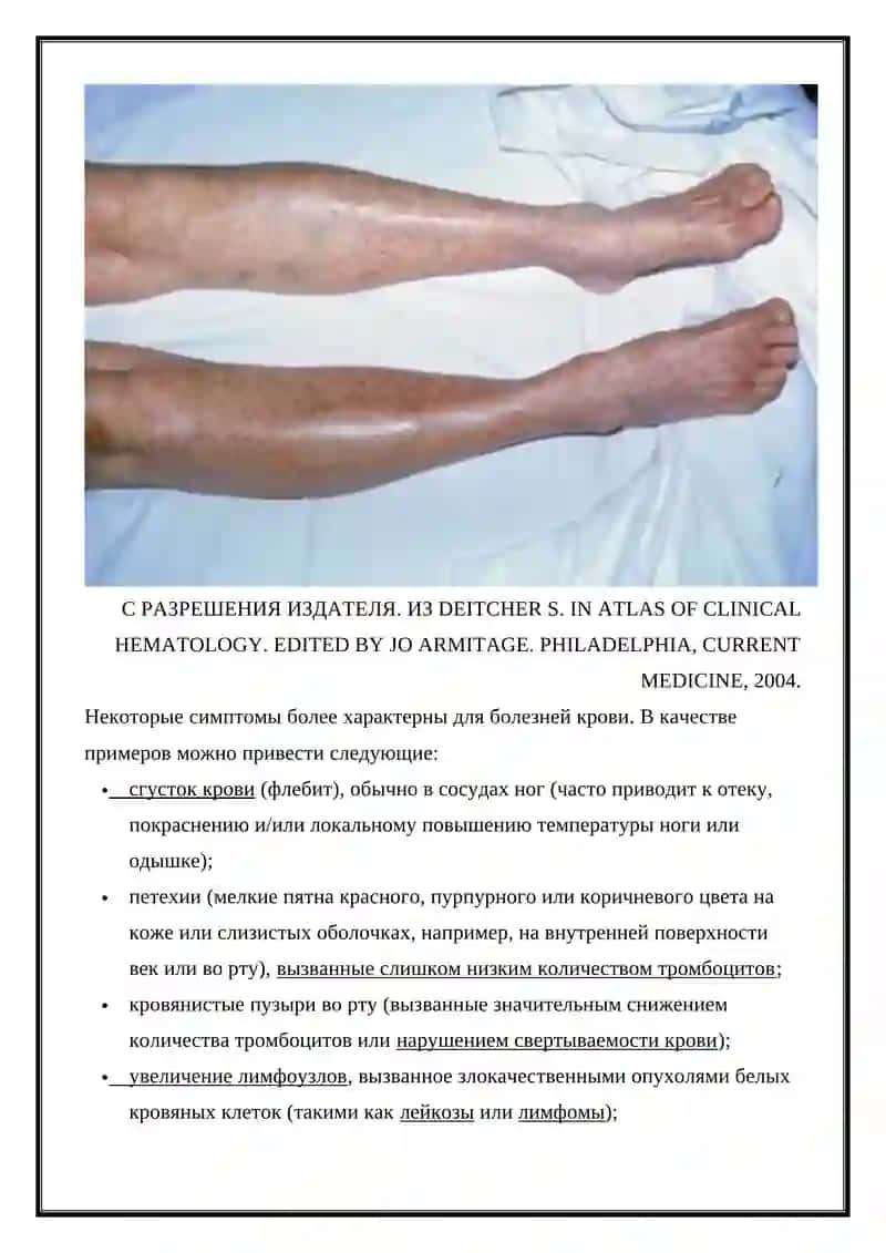 ЗАБОЛЕВАНИЯ ТОНА КРОВИ 3