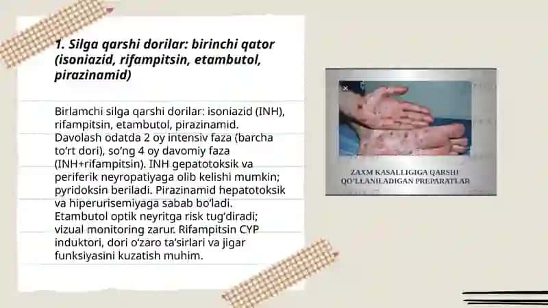 Silga qarshi vositalar 3