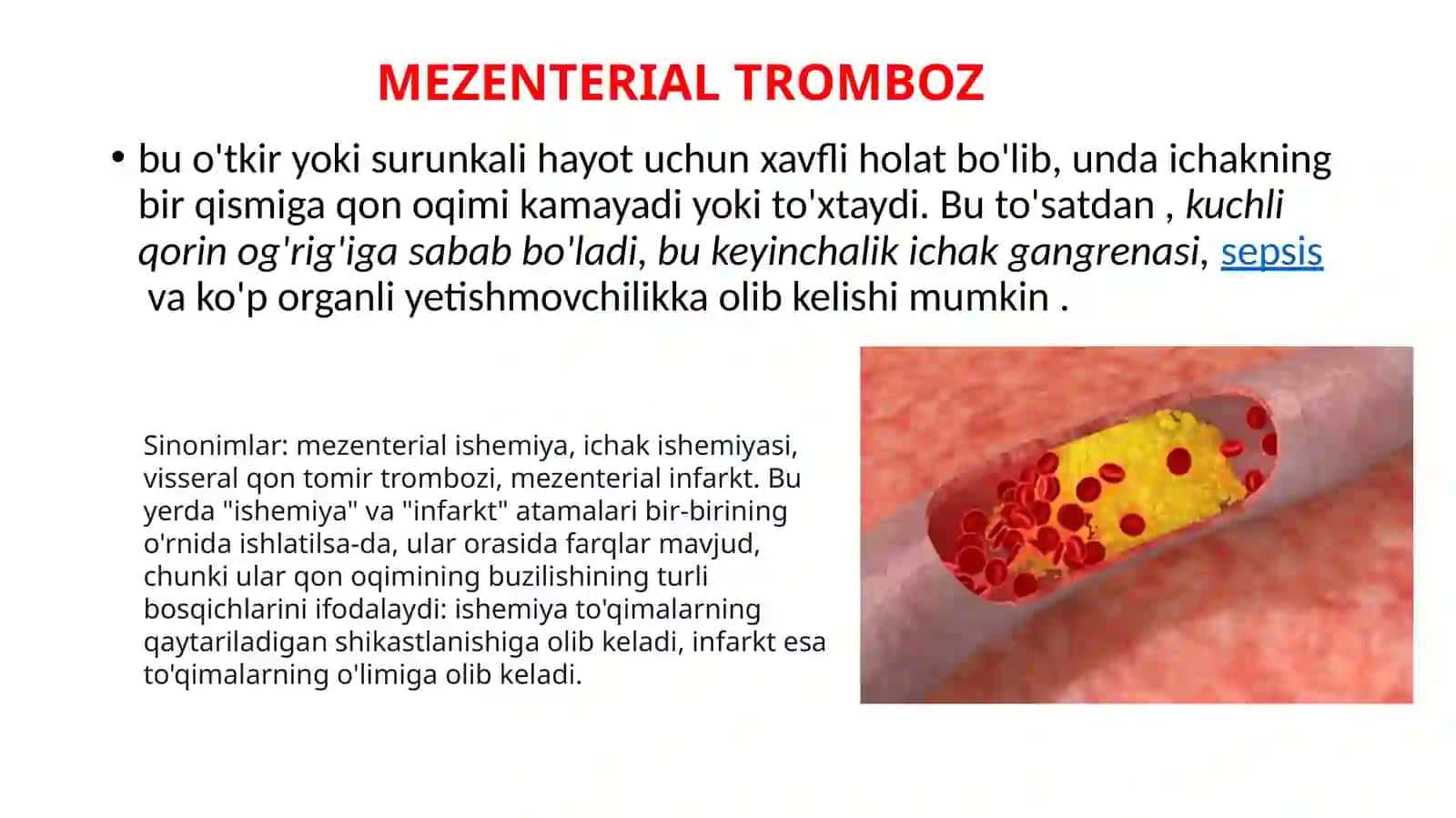 MEZENTERIALTROMBOZ 3