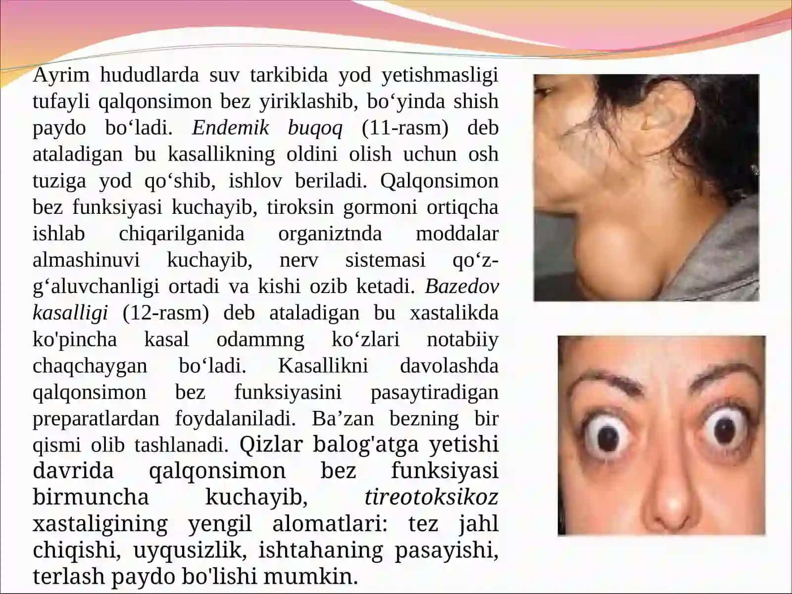 Qalqonsion bez 3
